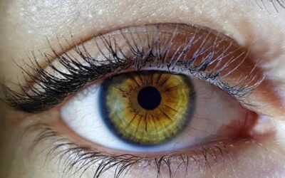 Pegcetacoplan previene la degeneración macular