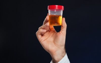 Tratamiento de los cálculos renales | Avances médicos