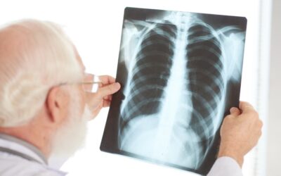 Tuberculosis: entre las diez primeras causas de muerte en el mundo