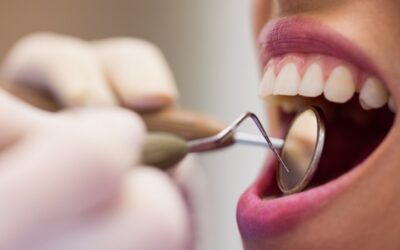 Todo lo que debes saber de la periodontitis