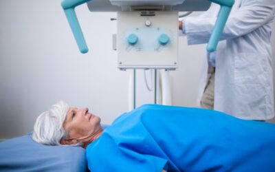 IMRT: alternativa para cáncer de útero y cuello