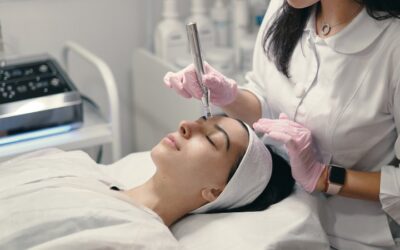 Microneedling: qué es, beneficios y cómo cuidar tu piel de la terapia