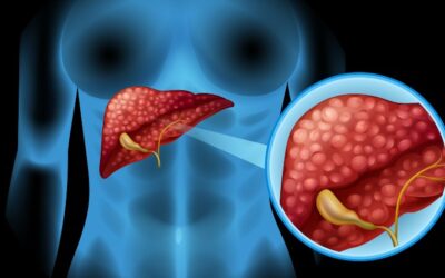 Enfermedades hepáticas: conoce las diferentes tecnologías para diagnosticarlas