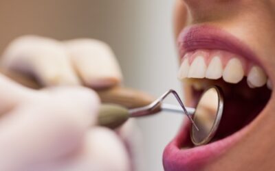 Edentulismo: ¿qué es y cómo prevenirlo?