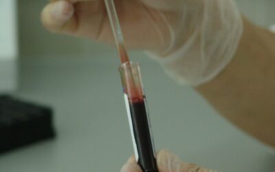 Hallazgo médico | Curación del  VIH con células madre
