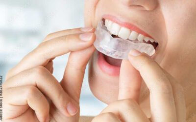 Bruxismo y desgaste dental
