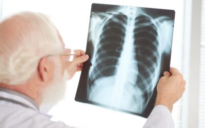 La tuberculosis, una enfermedad infecciosa