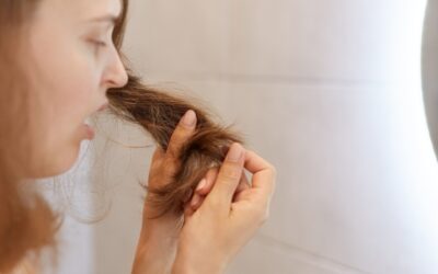 Alopecia androgenética causa el 30% de los casos de caída del cabello en mujeres