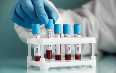 Sars cov 2 oncolítico | ¿Podría ser un tratamiento para el cáncer?   