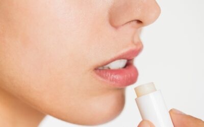 Labios agrietados: Principales causas y cómo prevenirlas