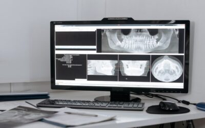 ¿Ya sabes qué es el diseño de sonrisa en odontología?
