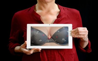 Tips  para prevenir las estrías en los senos