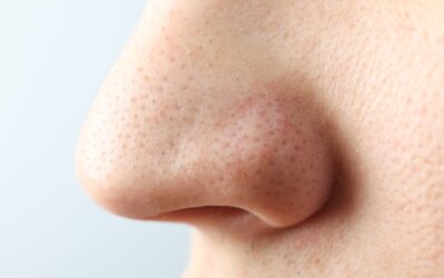 ¿Sufres de poros abiertos? Descubre como hacer para que no se note en tu maquillaje