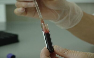 Cáncer colorrectal | Conoce los factores de riesgo