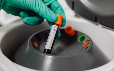 Leucocitos: conoce cuáles son los valores óptimos para tu salud