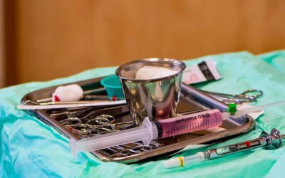 Anestesia epidural | Conoce los efectos secundarios