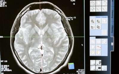 Ventajas de la Resonancia magnética como prueba diagnóstica