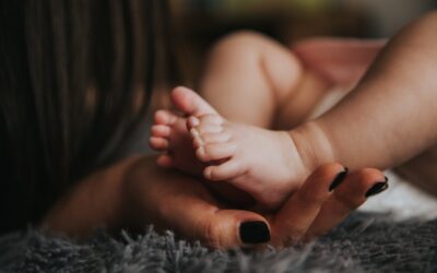 Sindactilia | Una deformidad genética que puede ocultarse