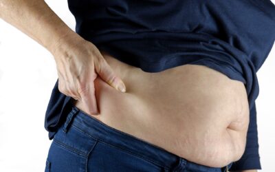 Tipos de obesidad: riesgos y tratamientos