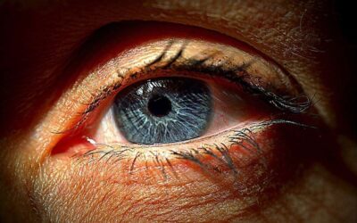 Conjuntivitis alérgica