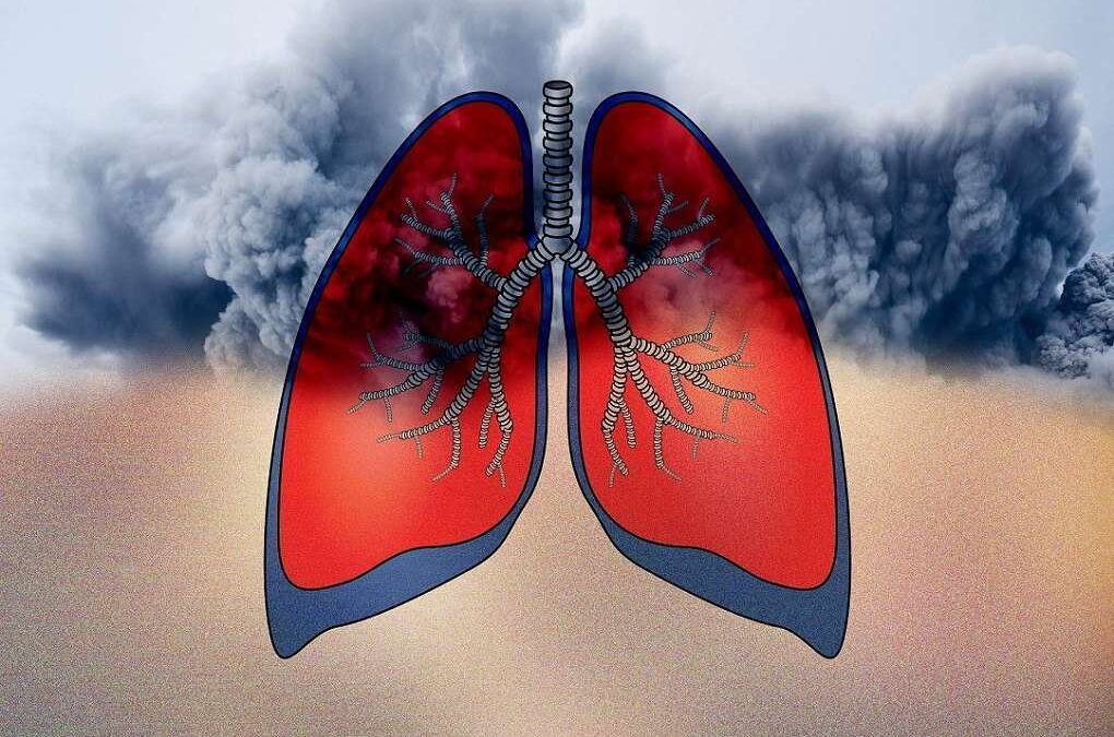 ¿Puede una alergia ser la causa del asma o no es vinculante?