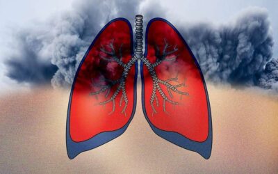 ¿Puede una alergia ser la causa del asma o no es vinculante?