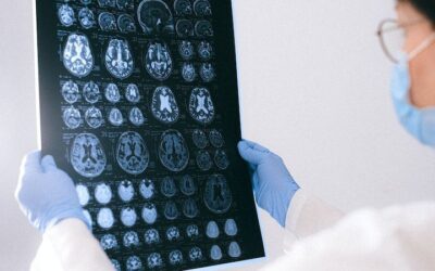 Neuropatía periférica | La enfermedad que perjudica la salud de Chyno Miranda