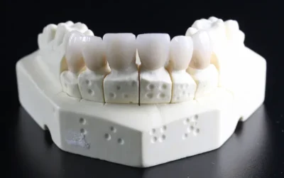 Amalgamas o resinas: ¿Cuál es la mejor solución dental?