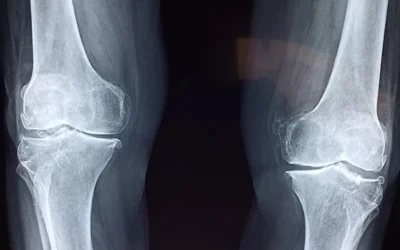 El rol de la imagenología en la salud deportiva