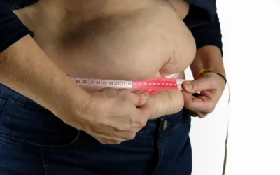 La cirugía bariátrica ¿Es una moda o una necesidad?