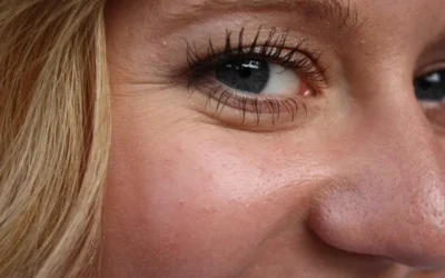 ¿Arrugas en el área de los ojos? Algunos remedios para atenuarlas