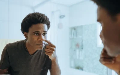 Rinoplastia masculina: detalles que desconocías sobre su procedimiento