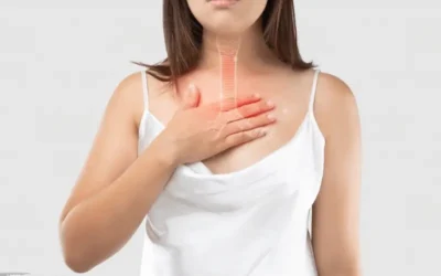 Condición de reflujo gastroesofágico: Qué es, síntomas, causas