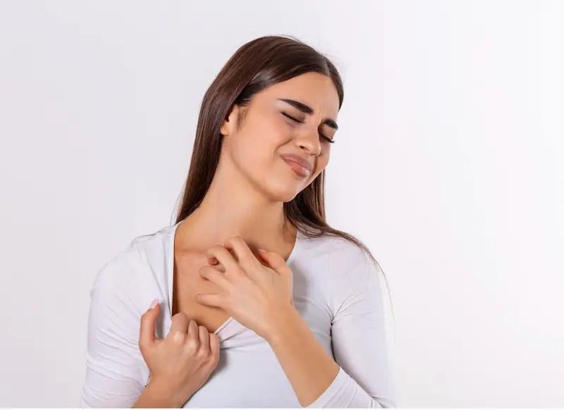 neurodermatitis
