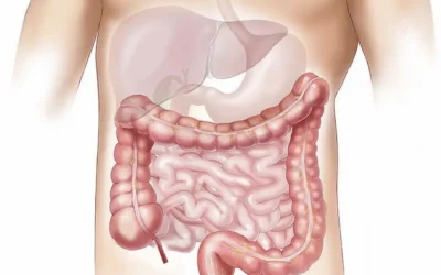 El colon irritable ¿qué es? ¿cómo prevenirlo?