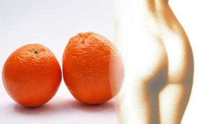 Piel de naranja: remedios naturales que ayudan a eliminarla
