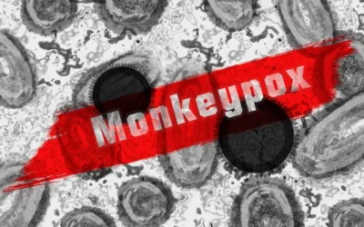 Viruela del mono: Todo lo que necesitas saber sobre este virus emergente