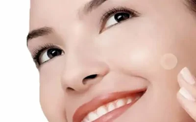 Parches para el acné: ¿Remedio inesperado para las picaduras de mosquitos?