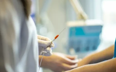 Radioterapia de intensidad modulada (IMRT): un avance en la lucha contra el cáncer