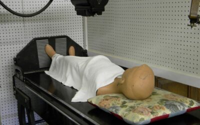 Claves sobre el linfoma cerebral: lo que necesitas saber