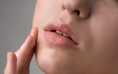 Labios agrietados: Soluciones caseras para una sonrisa suave y saludable
