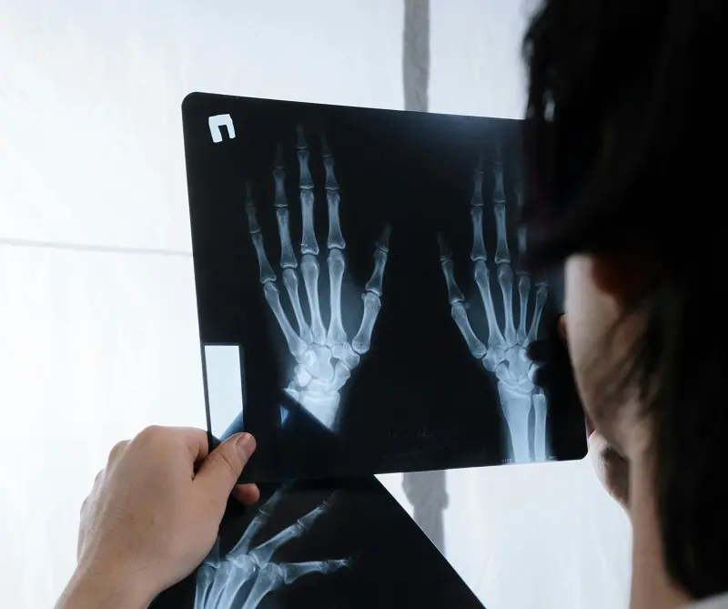 Nódulos de Bouchard