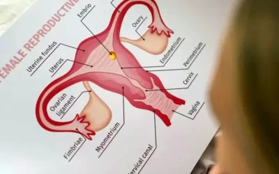 Fármacos Contra el Cáncer de Ovario: Un Avance Prometedor