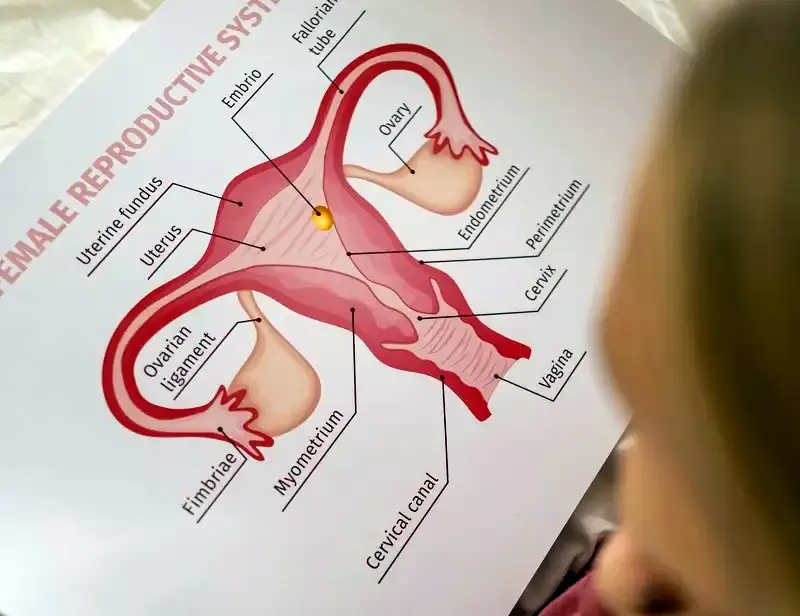 Fármacos Contra el Cáncer de Ovario: Un Avance Prometedor