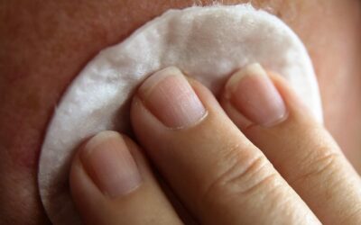 Dermatoscopia digital: Un aliado clave para la salud de tu piel