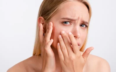 Descubre el resplandor natural: Las mejores mascarillas caseras para piel seca