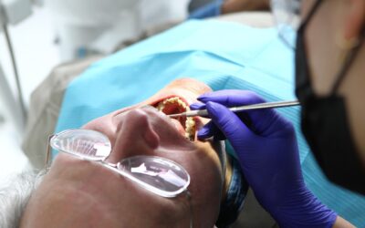 Implantes dentales: La revolución digital en tu sonrisa