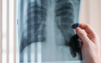 Primer Trasplante de Pulmón de Cerdo a Humano: Un Hito que Cambia la Medicina