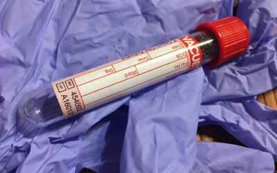 El cáncer de tiroides: un diagnóstico a tiempo es tu mejor defensa