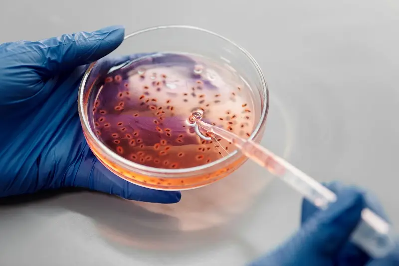 Citomegalovirus